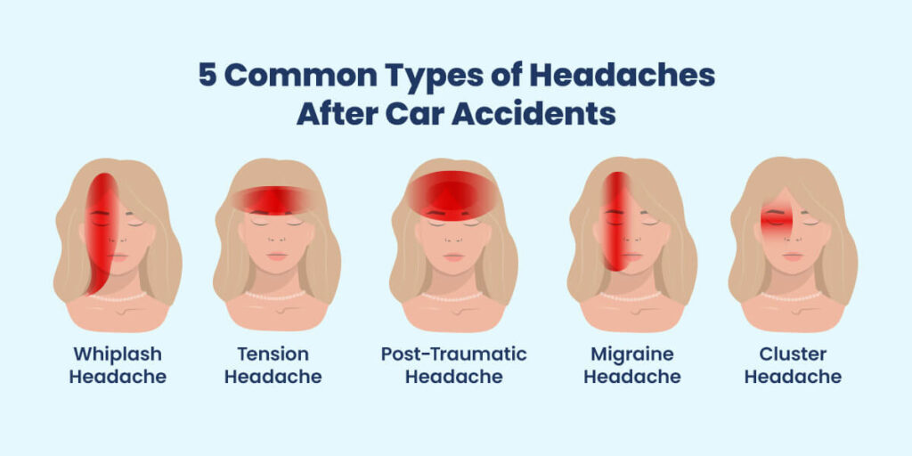 types of headaches after a car accident